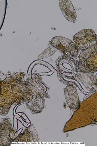 Huevos y larvas de Globodera